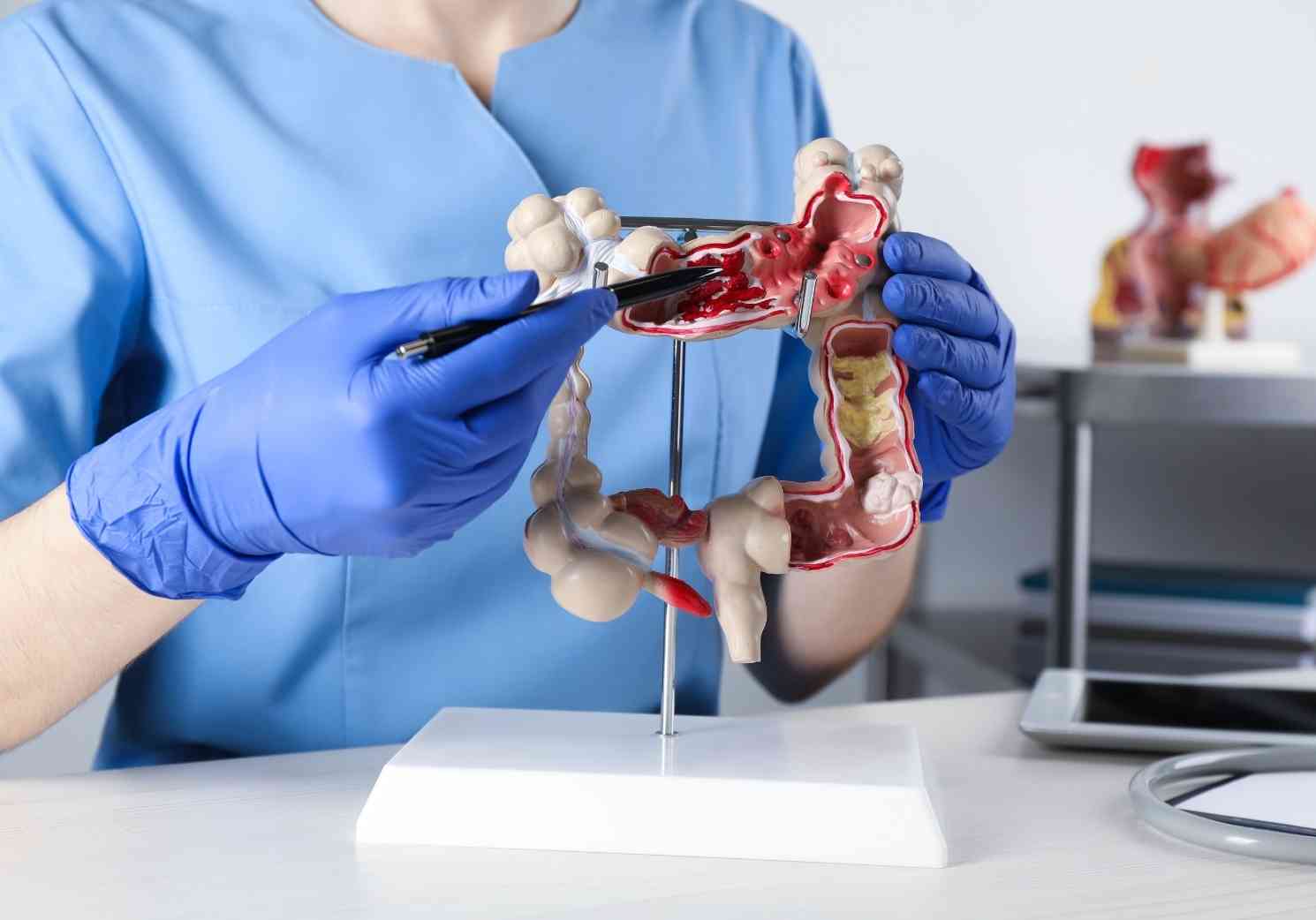 Screening patologie colon-retto a Progresso Medico